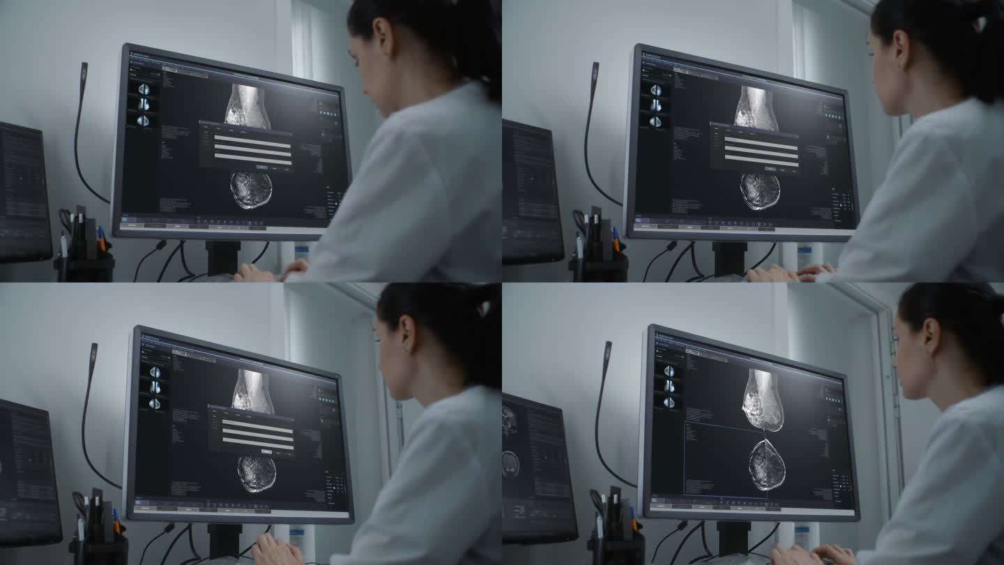 女医生在电脑上检查乳房x光检查结果