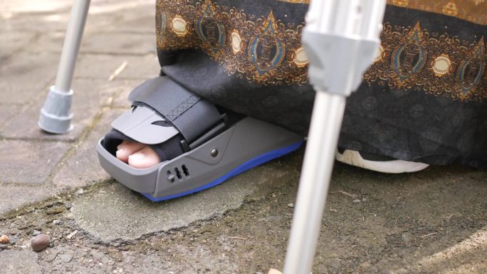 女性骨折的脚与灰色塑料靴踝关节护具受伤保护靴