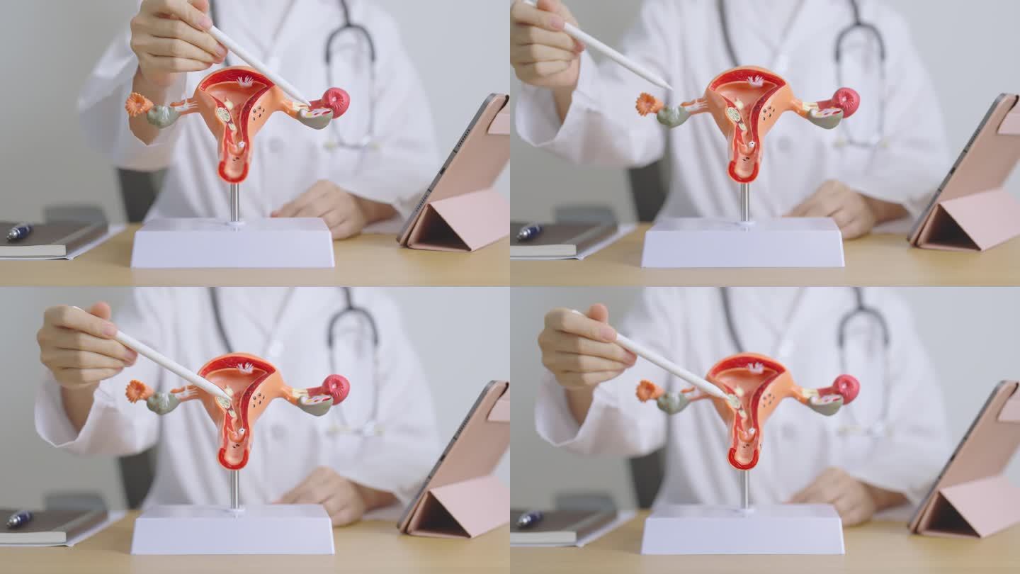 医生有子宫和卵巢解剖模型和片剂。卵巢癌和子宫颈癌，子宫颈疾病，子宫内膜异位症，子宫切除术，子宫肌瘤，