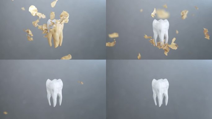 3d动画将牙菌斑从牙齿上清除。