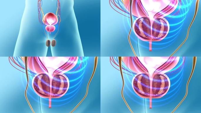 修复前列腺排尿不畅 前列腺炎 性功能增强