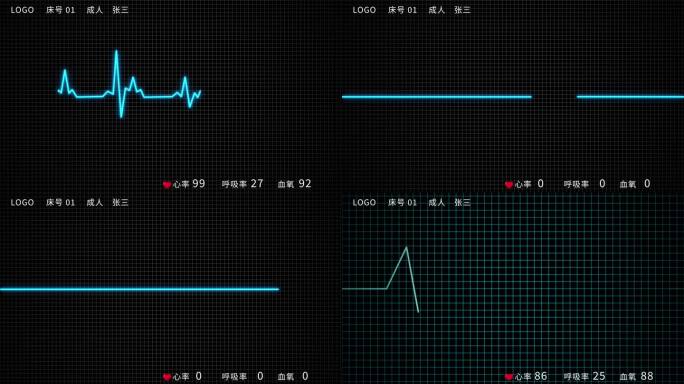 【AE工程】心电图心率跳动4K