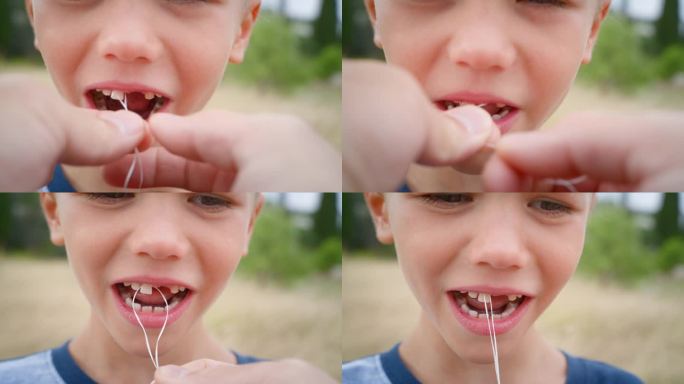 试图用一根线拔掉男孩的前乳牙。