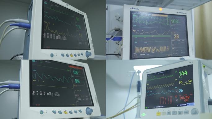 一组心电图镜头多角度多个医疗器械4K