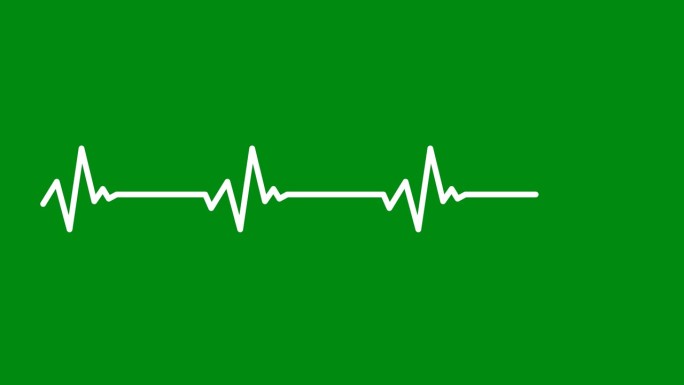 在绿色背景上分离的心电图的说明性动画