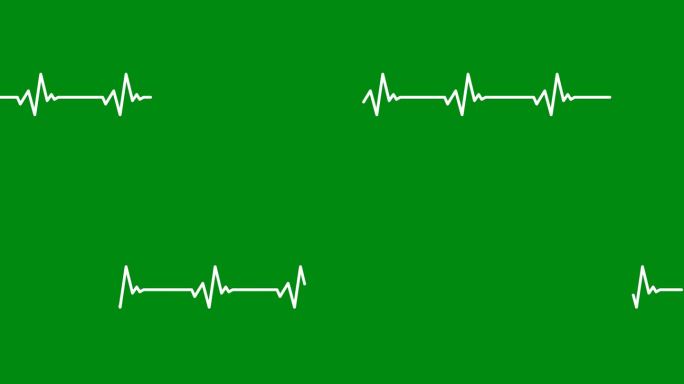 在绿色背景上分离的心电图的说明性动画