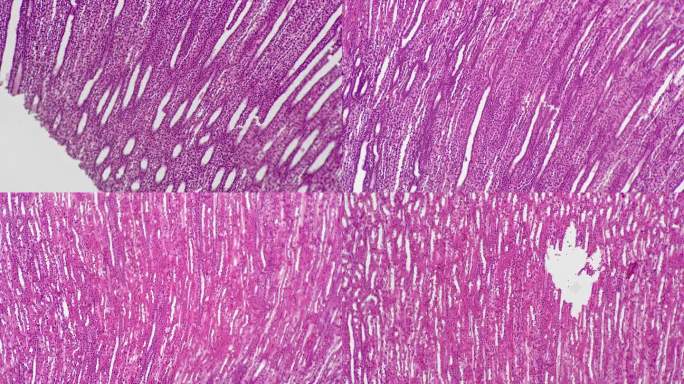 亮视野下100倍显微镜下拍摄的人肾血管注射切片