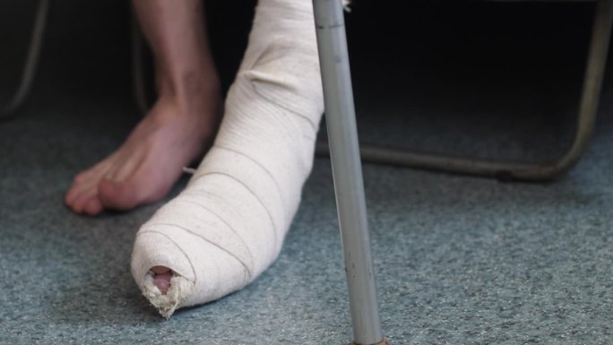 一个用石膏包扎着断腿的男人从沙发上站起来，拄着拐杖在里面走路。外伤概念，腿骨骨折，腿骨骨折康复