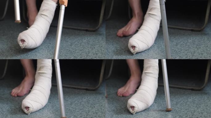 一个用石膏包扎着断腿的男人从沙发上站起来，拄着拐杖在里面走路。外伤概念，腿骨骨折，腿骨骨折康复