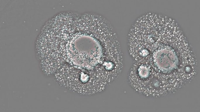 通过显微镜观察变异的细菌细胞医学研究背景