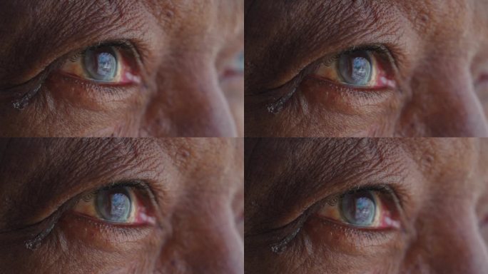 非洲裔美国人的眼睛宏观特写。一个黑人老人睁开了蓝色的眼睛