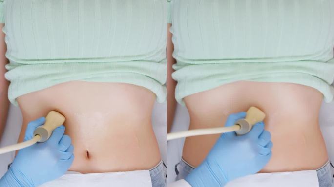 女性腹部超声检查检查身体做B超超声波检查