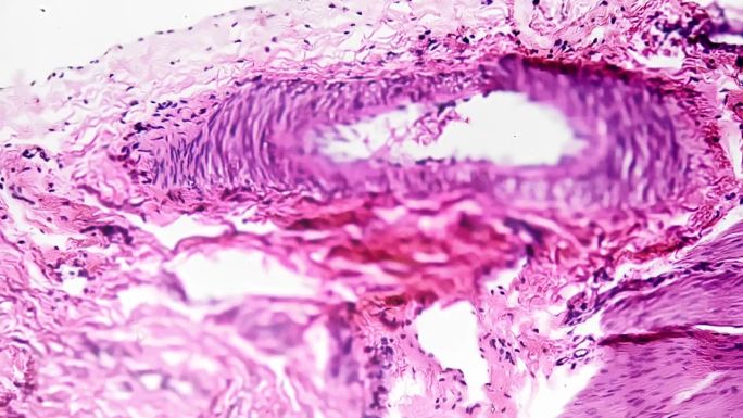 人膀胱在200x显微镜下切片，用于医学分析
