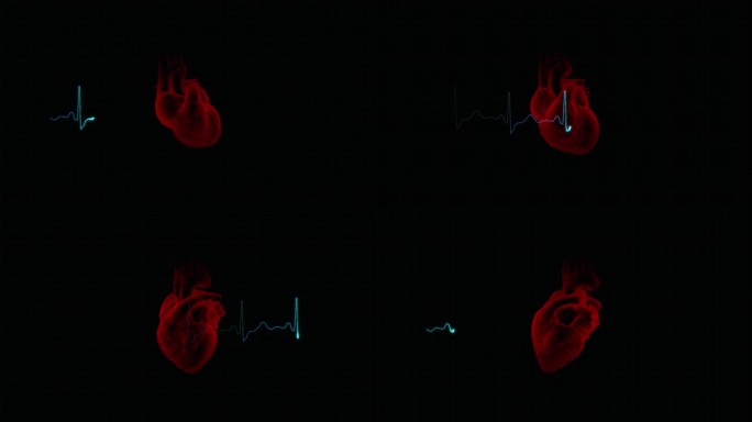 心电图心跳