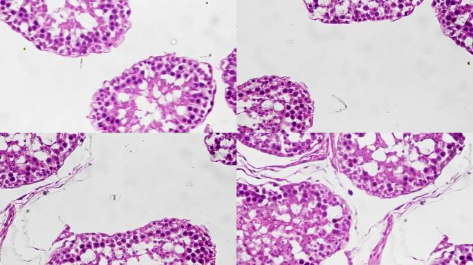 400倍放大镜下男性生殖系统睾丸的放大图