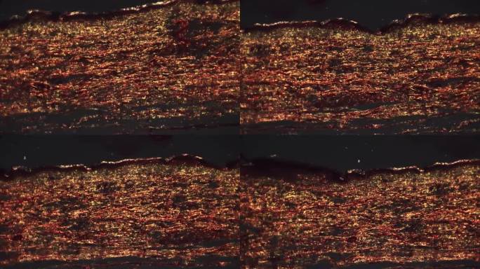 在100倍显微镜下交叉光下拍摄的人体皮肤切片显示厚的角质层