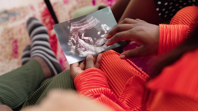孕妇向她的朋友展示超声图像