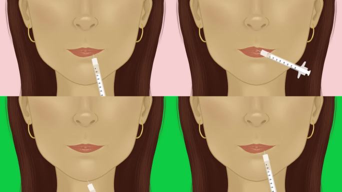 女性做丰唇手术，4k动画，增加嘴唇体积的整容手术