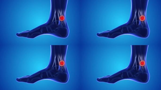 足部穴位按摩，缓解脚踝和脚后跟疼痛