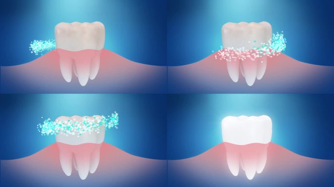 牙齿周围的蓝色颗粒清洁，使他们洁白闪亮，3D动画