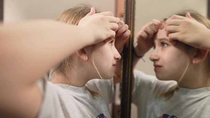 年轻的少女正对着镜子挤着脸上的痘痘。一个皮肤有问题的青少年的肖像。少女把脸上的痘痘捏得紧紧的。青春护