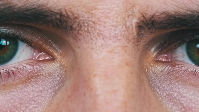 年轻男性脸上的真正黑眼圈，男性眼睑上的瘀伤