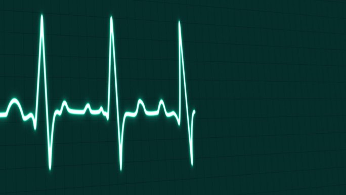 心电图频率心跳脉搏率线发光蓝色霓虹灯环动画蓝色网格背景。蓝色带网格。心率监测器。医疗保健理念。4k镜