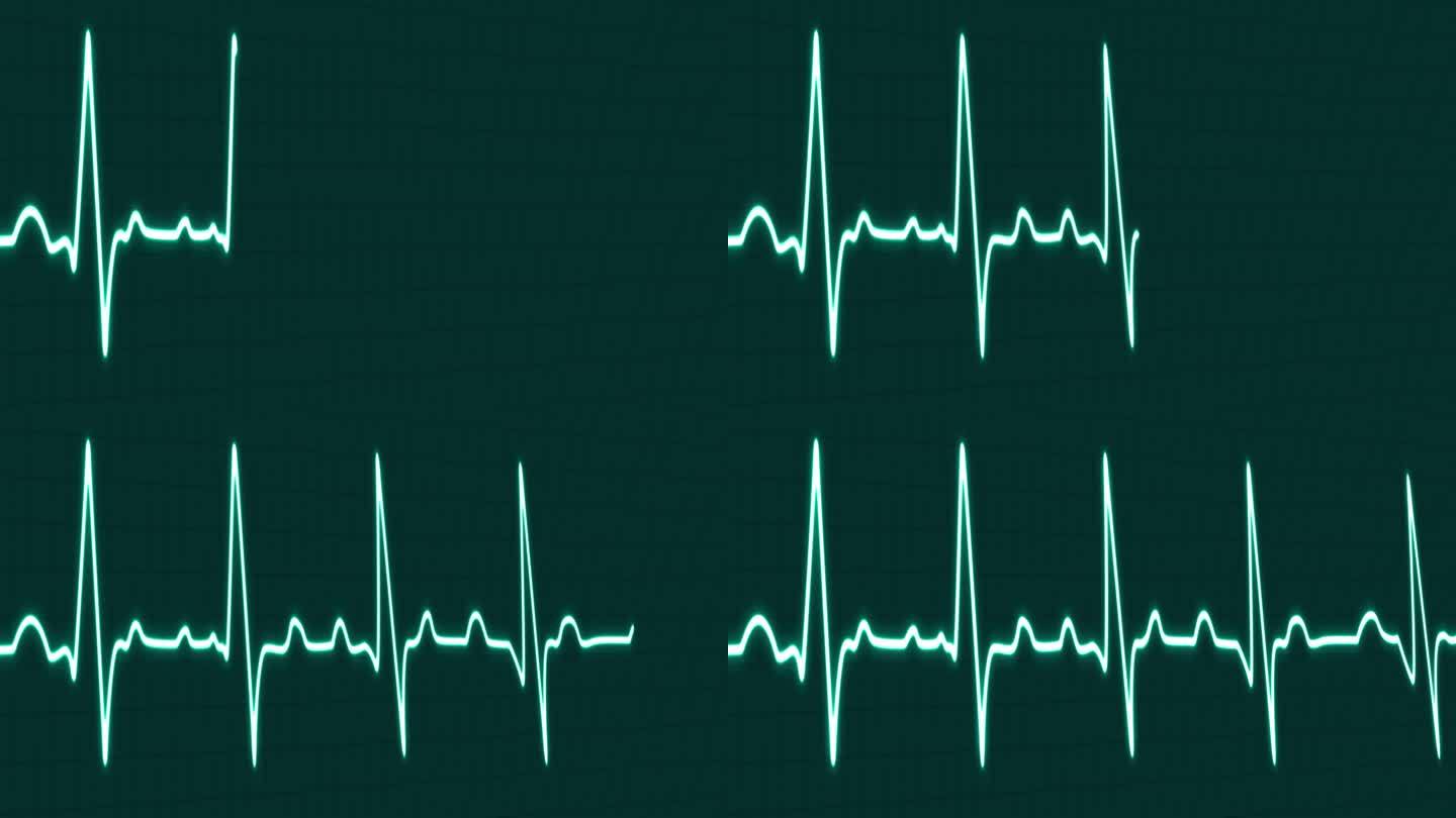 心电图频率心跳脉搏率线发光蓝色霓虹灯环动画蓝色网格背景。蓝色带网格。心率监测器。医疗保健理念。4k镜