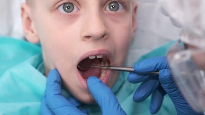牙医检查孩子的身体。儿童牙科。正畸医生检查男孩的口腔。锋利的牙痛。牙齿上有蛀牙。咬牙不正确。