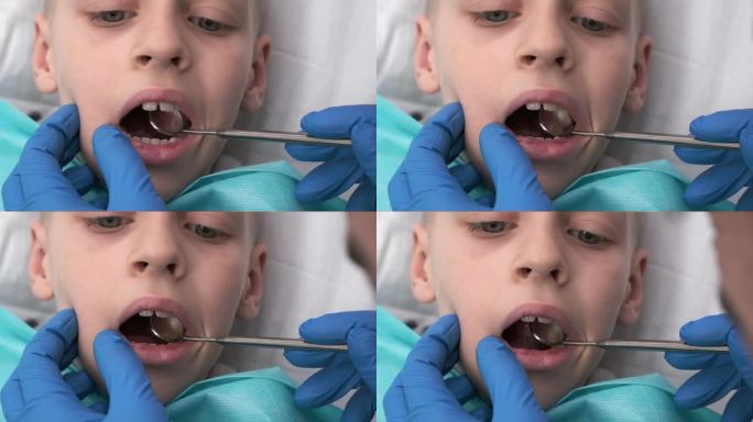 牙医检查孩子的身体。儿童牙科。正畸医生检查男孩的口腔。锋利的牙痛。牙齿上有蛀牙。咬牙不正确。