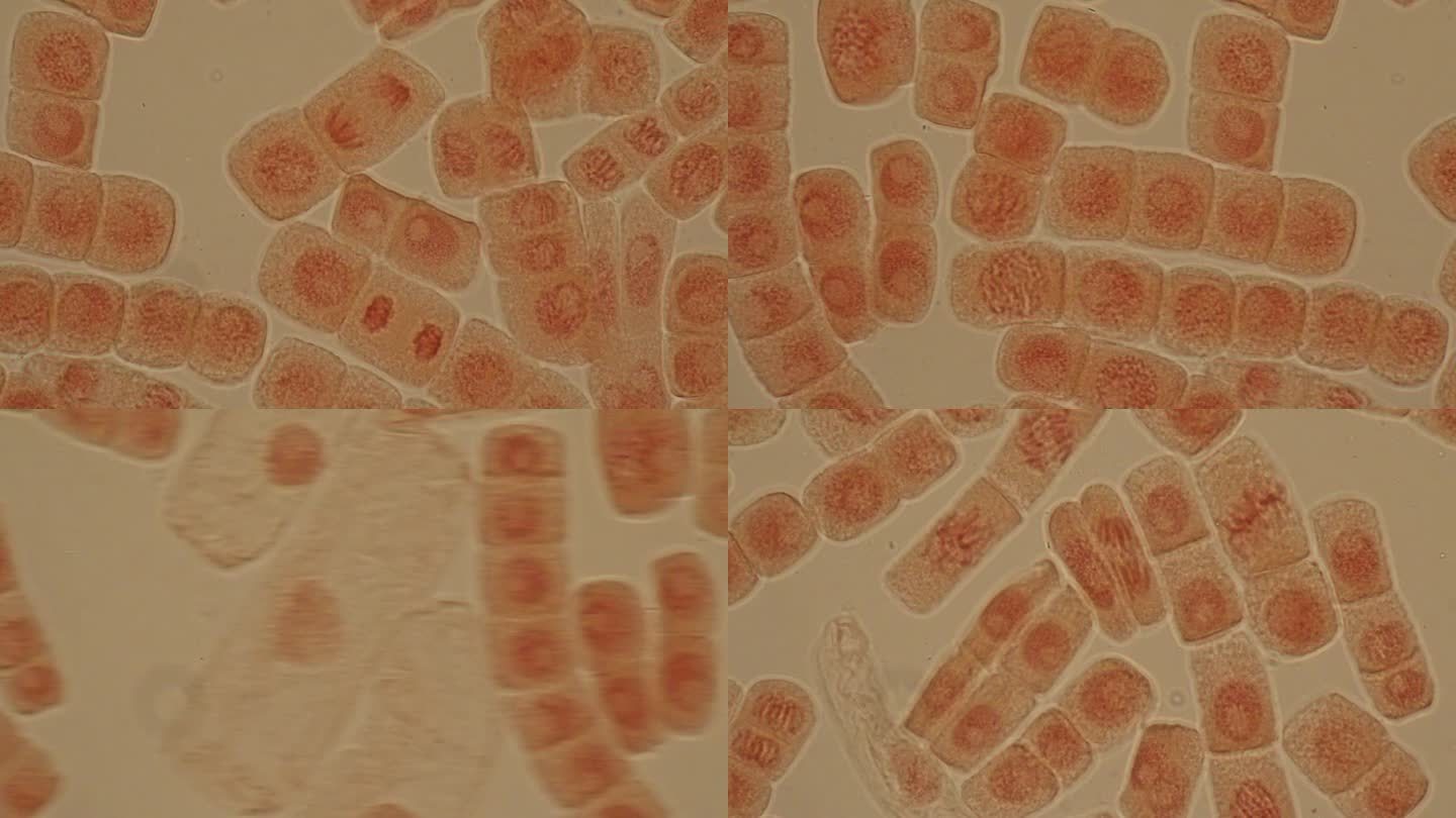 显微镜下洋葱根尖的有丝分裂细胞。