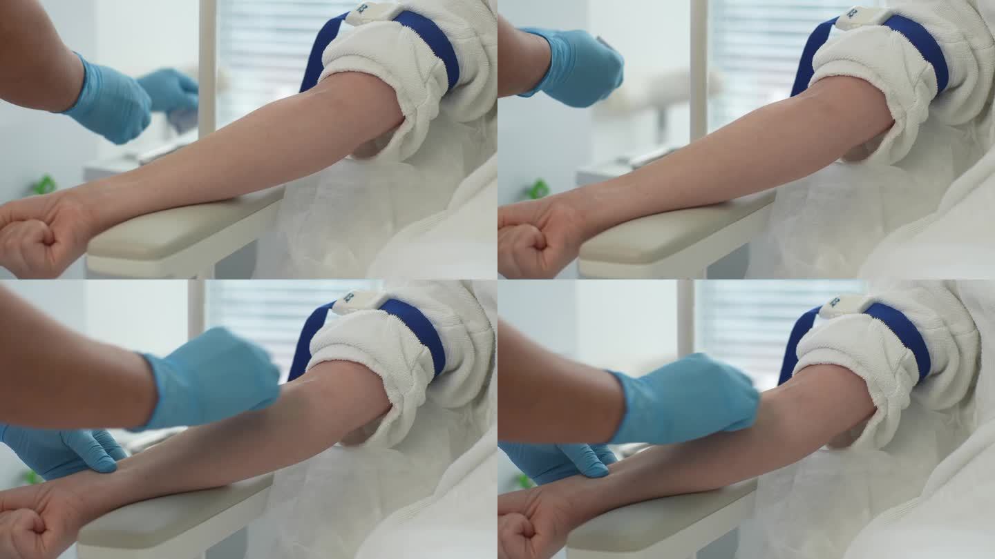 特写镜头中，无法辨认的女护士戴着医用手套，用棉絮擦拭静脉，在静脉中插入静脉注射针。