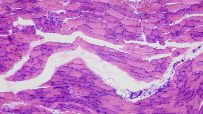 健美的肌肉。合成代谢和生长激素的作用。显微镜下的人体骨骼肌组织，放大400倍。纵切面。对焦和移动流畅