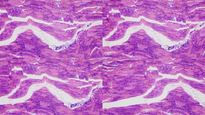 健美的肌肉。合成代谢和生长激素的作用。显微镜下的人体骨骼肌组织，放大400倍。纵切面。对焦和移动流畅