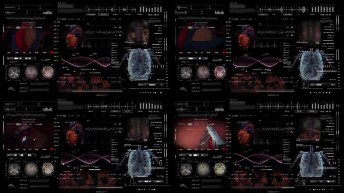 MRI x线扫描，显微外科关节镜手术。关节镜摄像屏幕。医疗HUD分析心脏诊断。dna。听频监测器。未