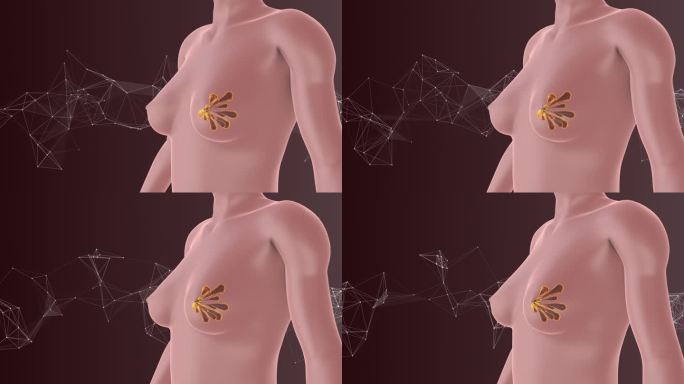 具有神经丛的乳腺癌细胞的概念可视化