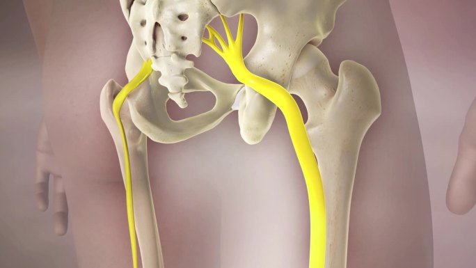 坐骨神经腿痛3D动画
