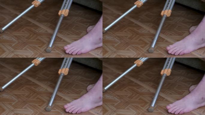 一名男子的腿骨折后，拆除了一名拄着拐杖坐着的男子的石膏。四肢骨折后的康复。是健康的