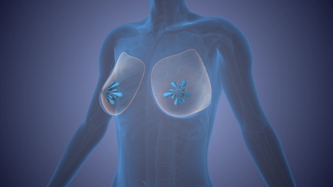 乳腺癌细胞的概念表示