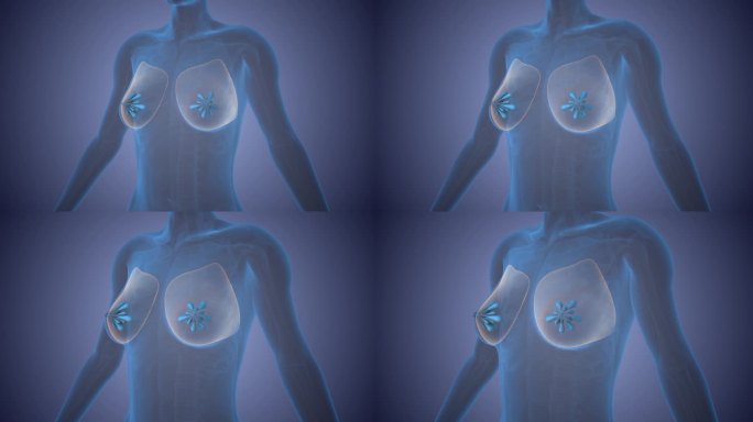 乳腺癌细胞的概念表示