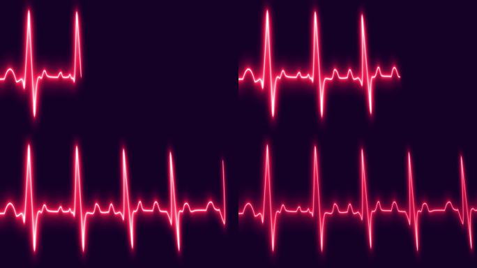 心电图心跳脉搏率发光红色霓虹灯循环动画背景。心电图60 BPM循环屏幕，蓝色带网格。心率监测器。医疗