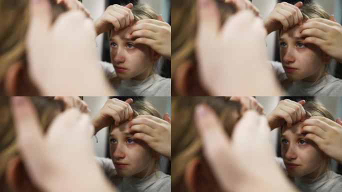 年轻的少女正对着镜子挤着脸上的痘痘。一个皮肤有问题的青少年的肖像。少女把脸上的痘痘捏得紧紧的。青春护