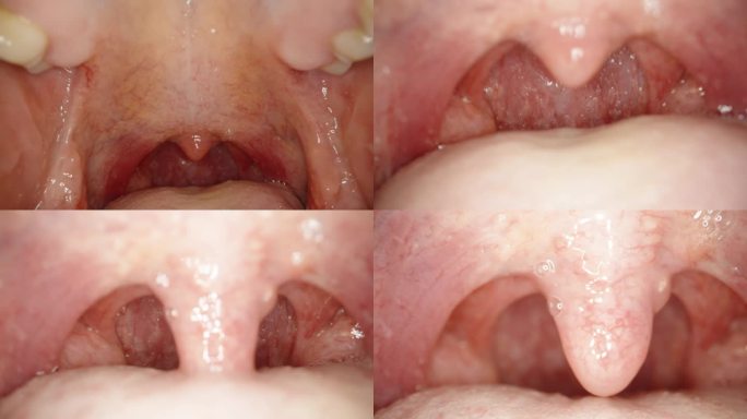 口腔检查对人口腔的检查口腔内的宏观探针。