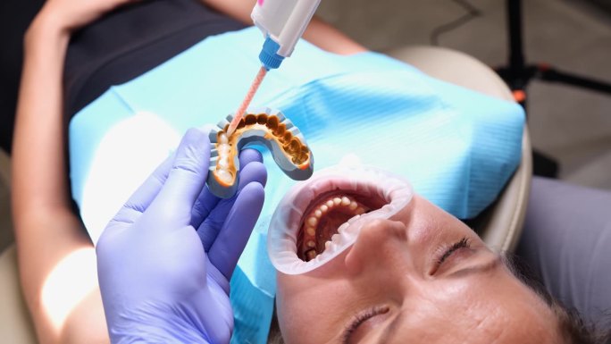 一名女子张大嘴巴看牙医，见上图