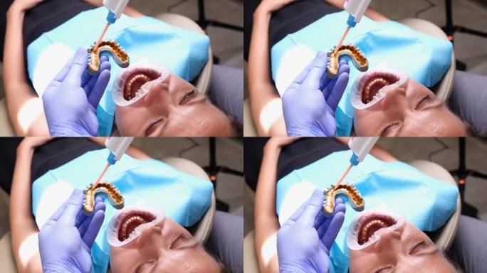 一名女子张大嘴巴看牙医，见上图