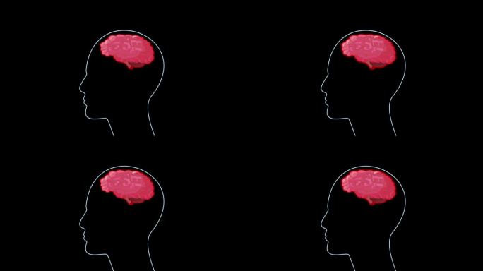医学动画的大脑和头痛的黑色背景。4 k循环