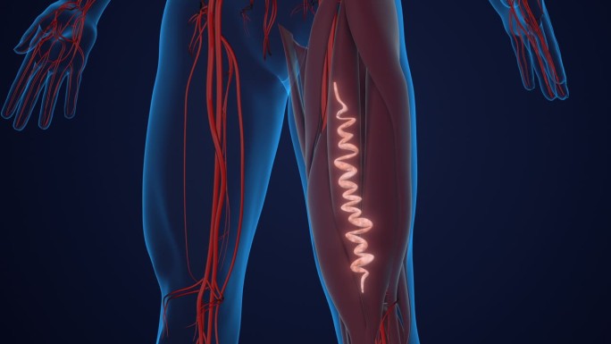 大腿的静脉曲张透视腿部血管