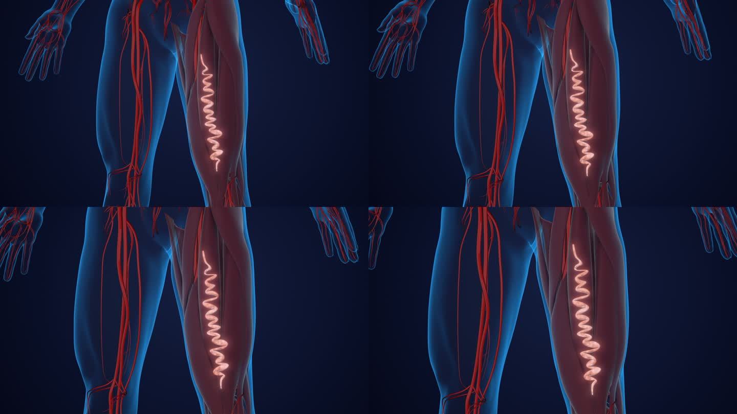 大腿的静脉曲张透视腿部血管