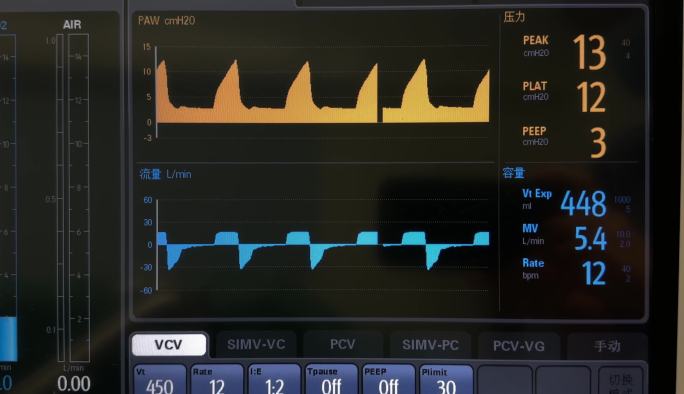 呼吸机监控屏幕：呼吸参数与气道压力显示