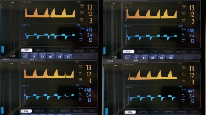呼吸机监控屏幕：呼吸参数与气道压力显示